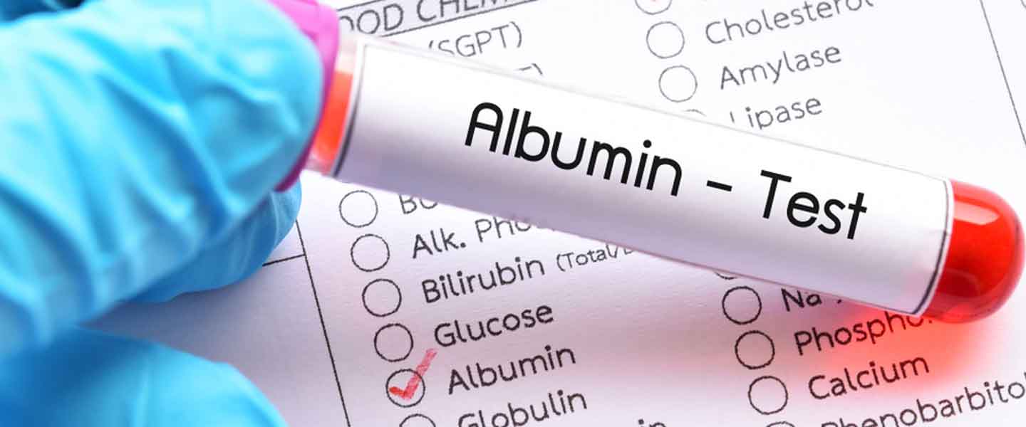 Albumin آلبومین