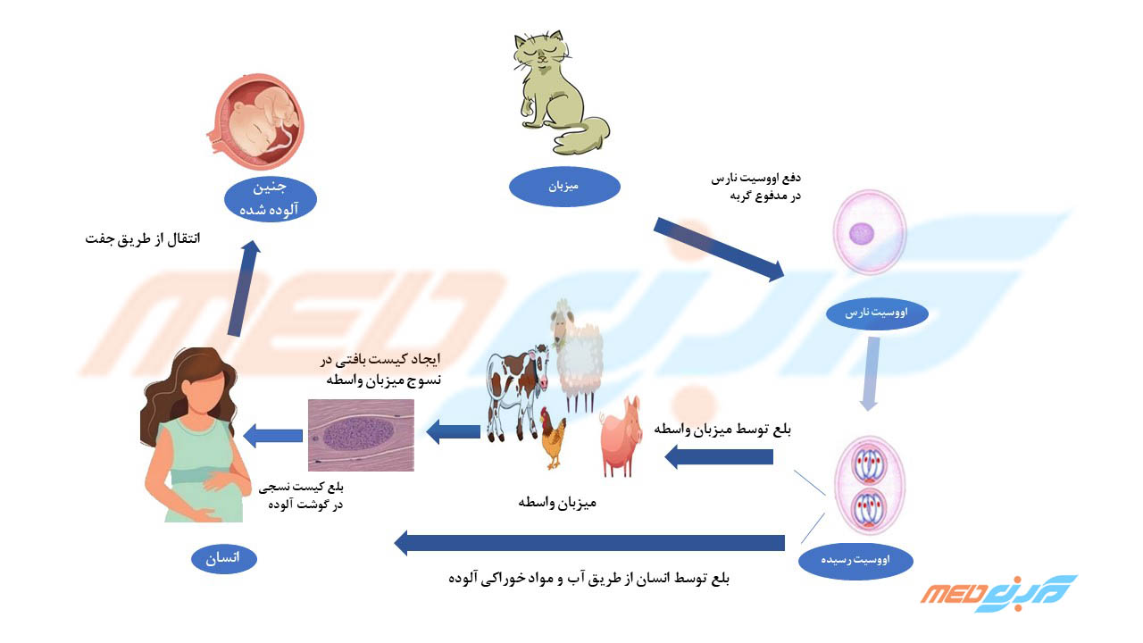 توکسوپلاسموزیس
